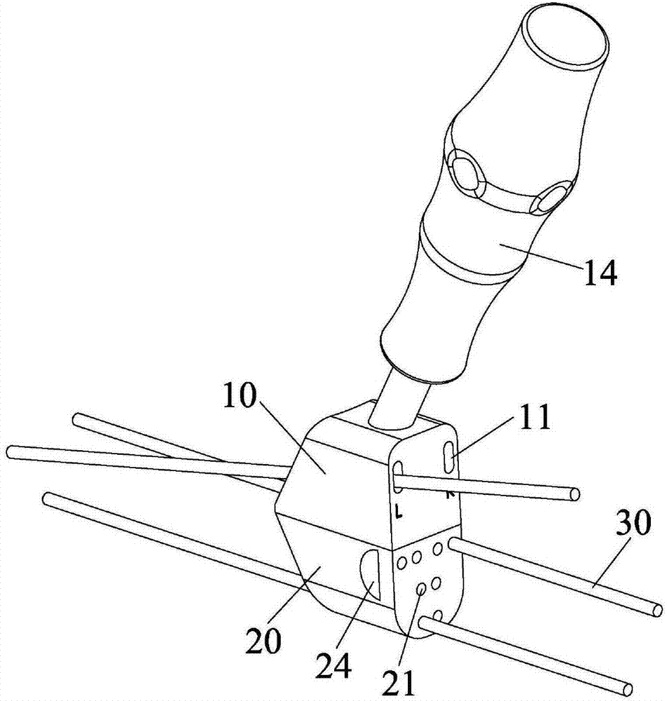 Femoral neck fracture hollow screw imbedding guide device