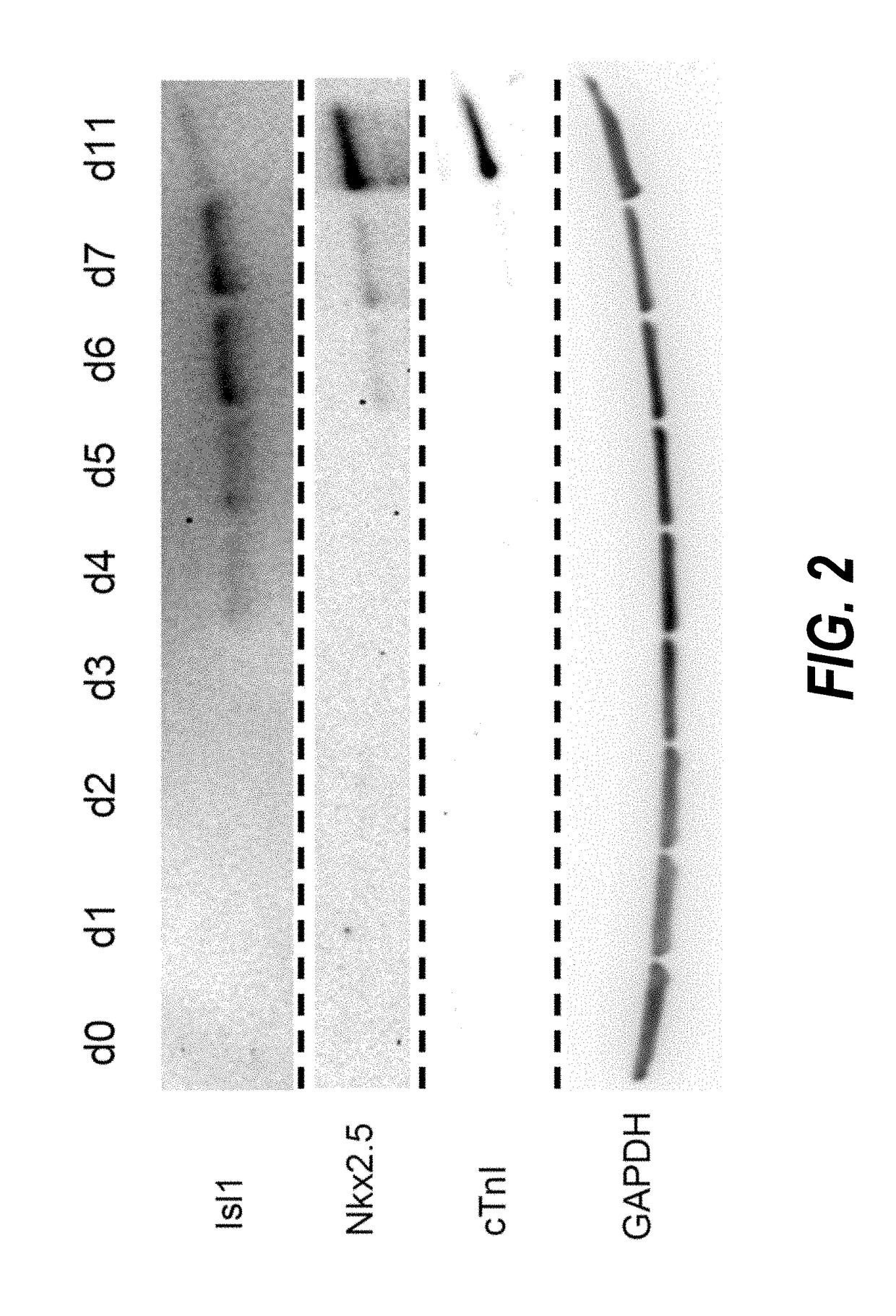 Methods for isolating human cardiac ventricular progenitor cells