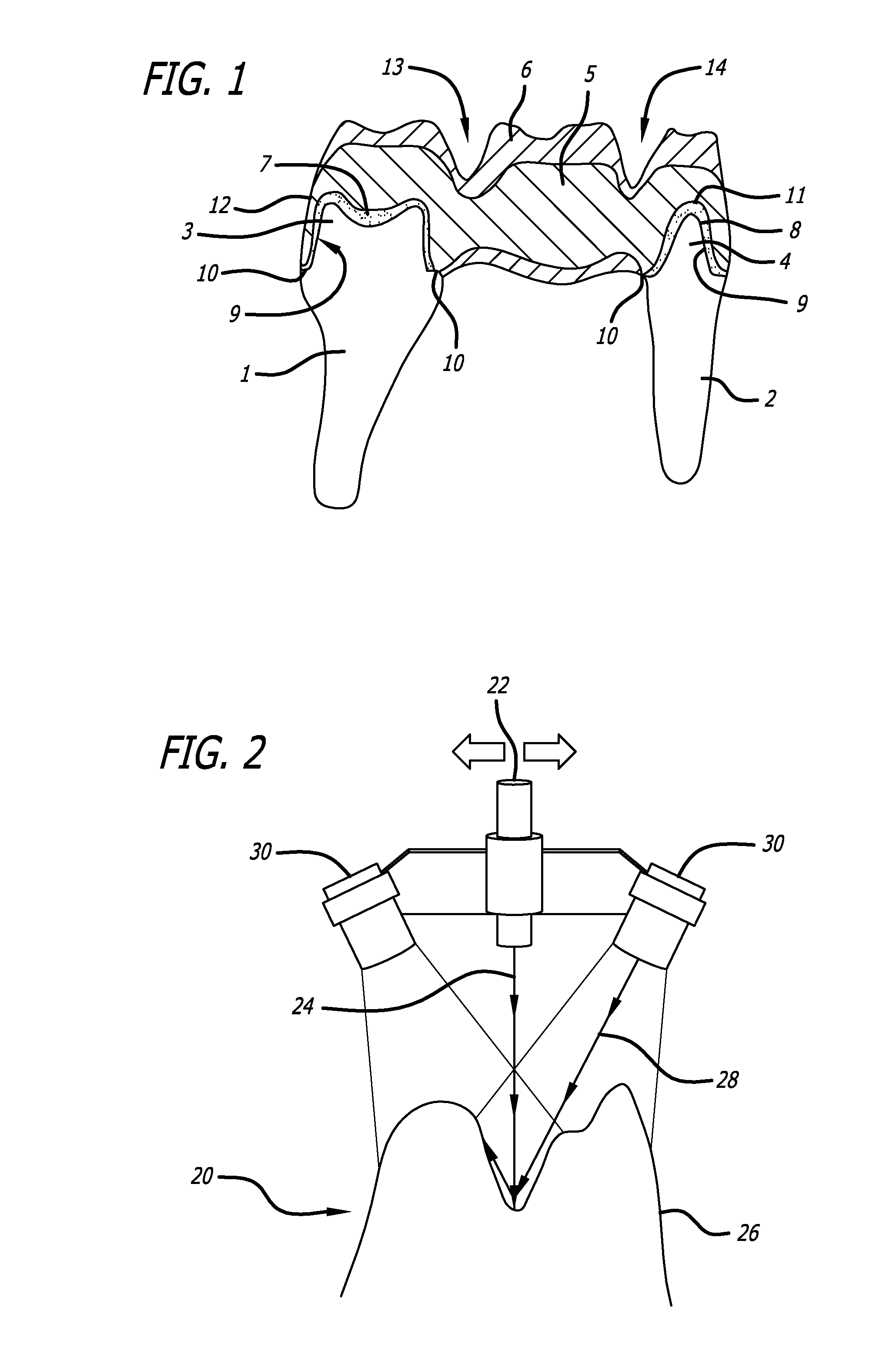 Process for making a dental restoration model