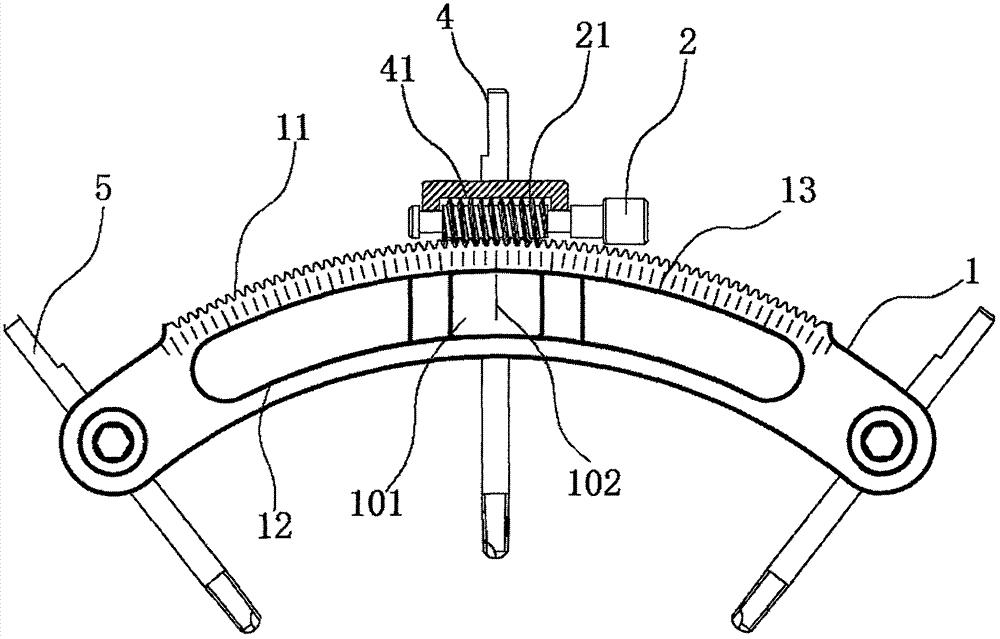 Worm gear skull annular rod combined external fixing bracket