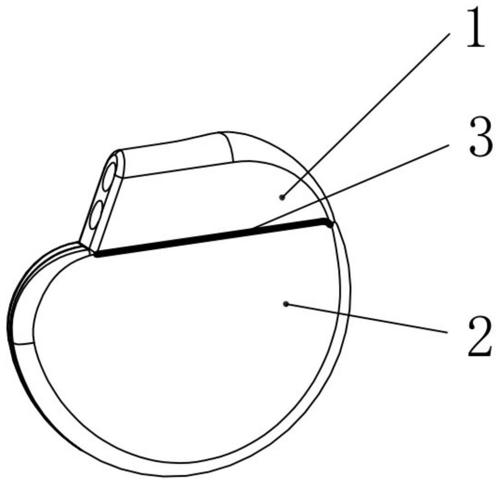 Surface roughening method of thin-wall metal shell implanted into human body