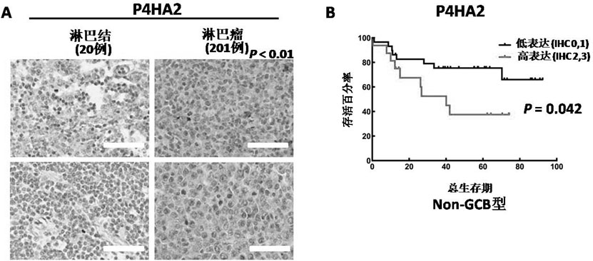 b Lymphoma and leukemia detection markers, kits and applications thereof