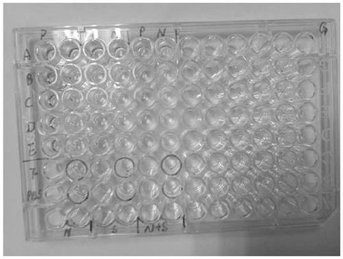 Kit for rapidly detecting novel coronavirus antibody based on mixed antigen