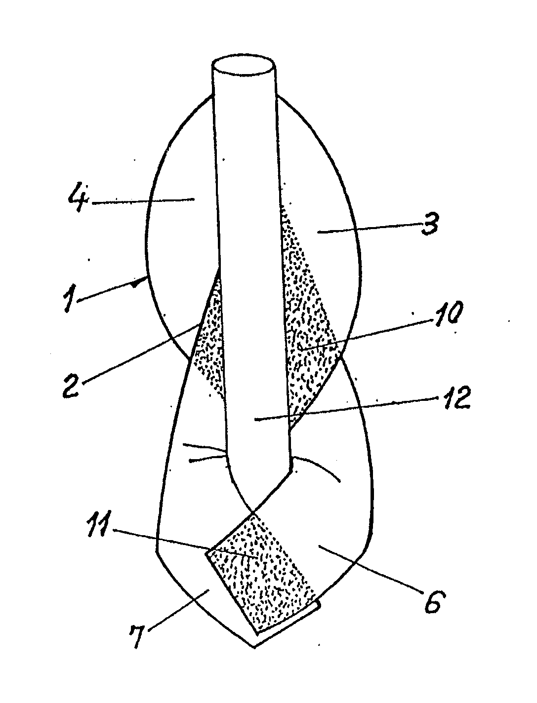Prosthesis and method for surgical treatment of inguinal hernias