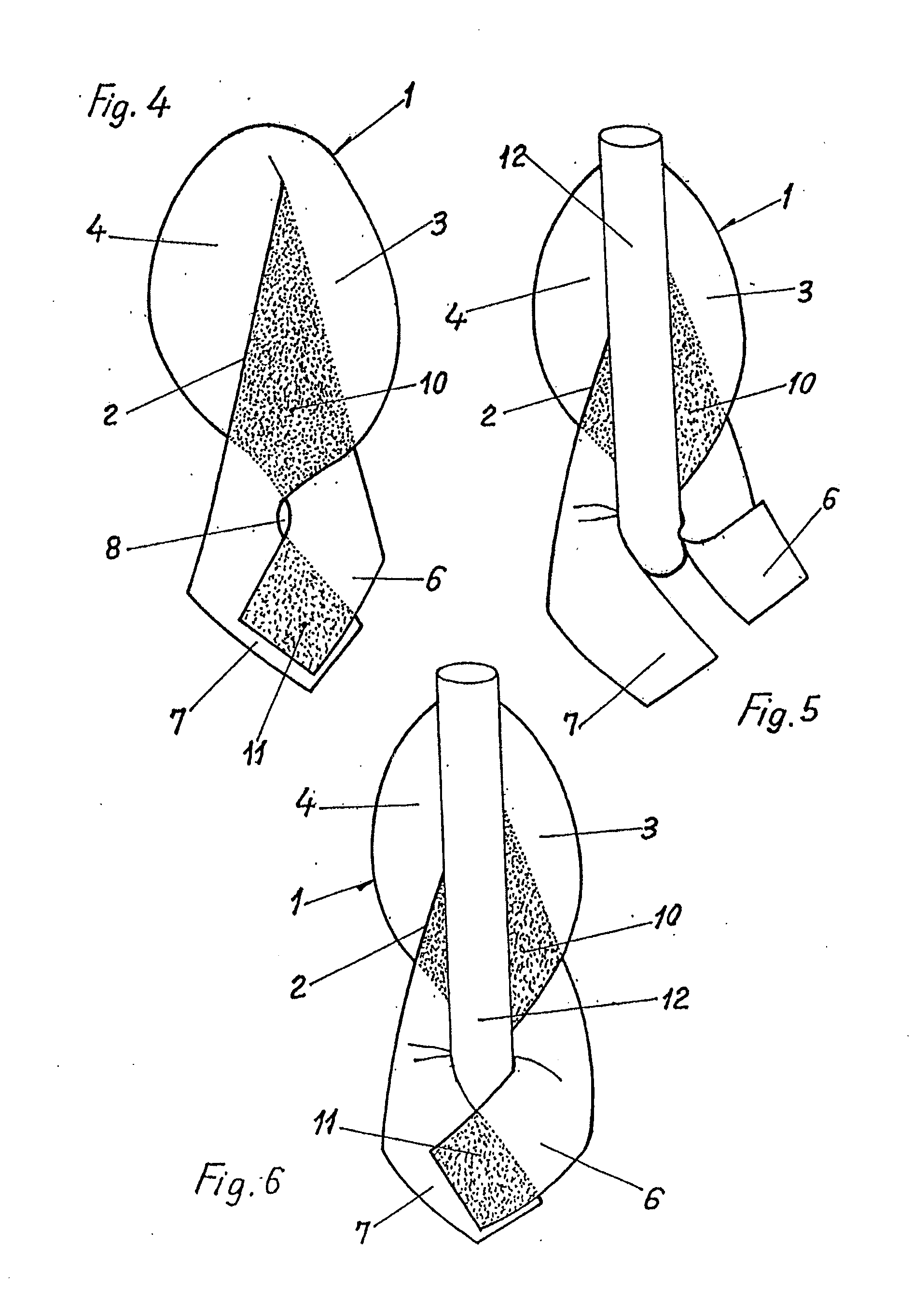 Prosthesis and method for surgical treatment of inguinal hernias