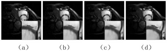 A cs-mri image reconstruction method based on non-convex constraints of ranking structure group