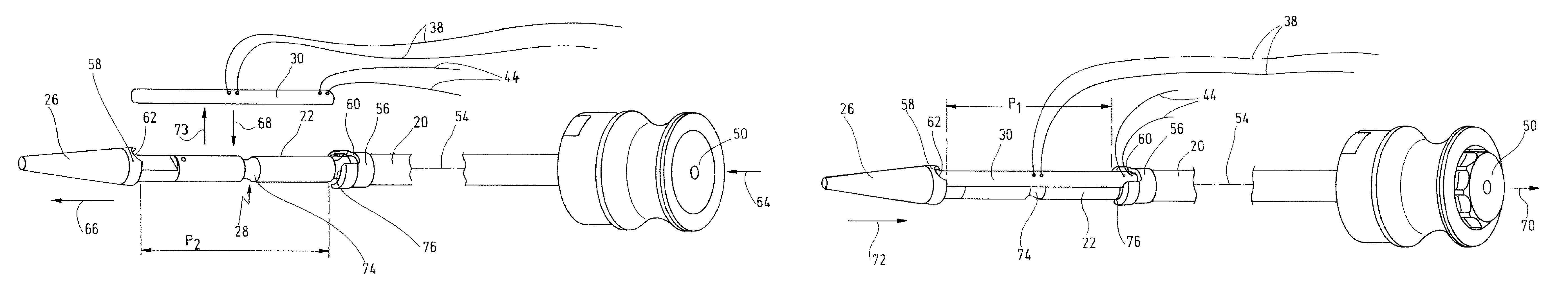 Device for inserting at least one anchor piece into a hollow space of a living being