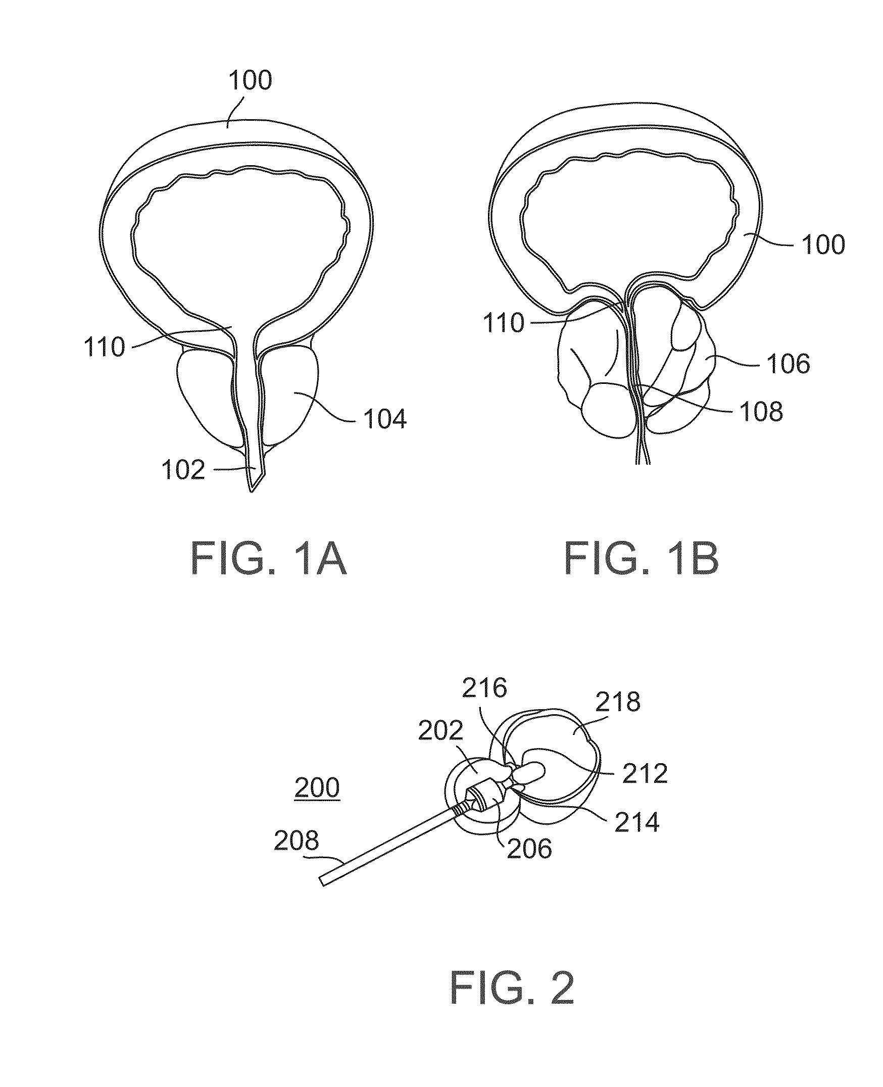 Methods and devices for urethral treatment