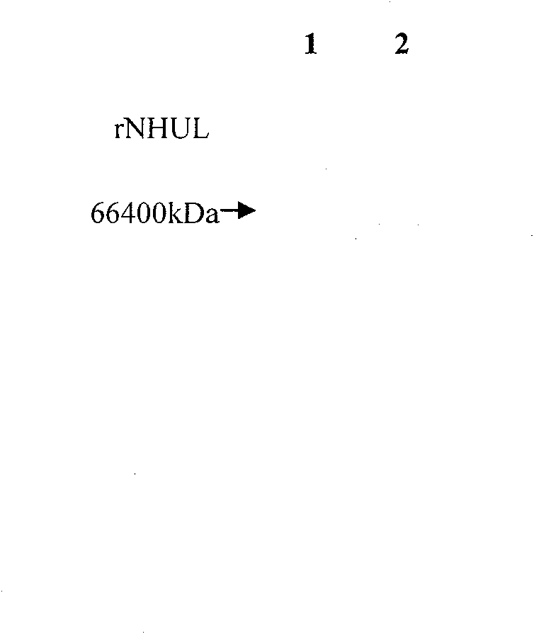 Pyloric spiral bacillus antigen recombinant vaccine