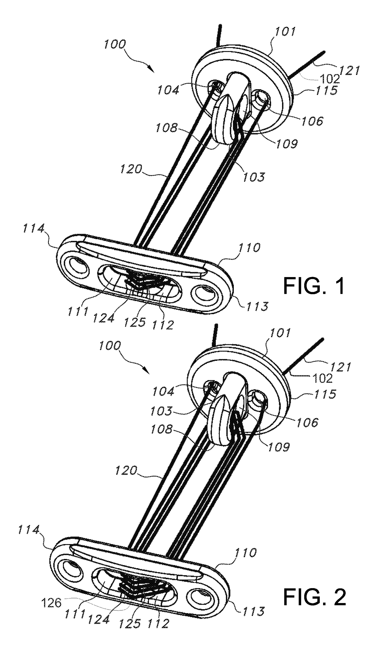 Knotless orthopedic stabilization system