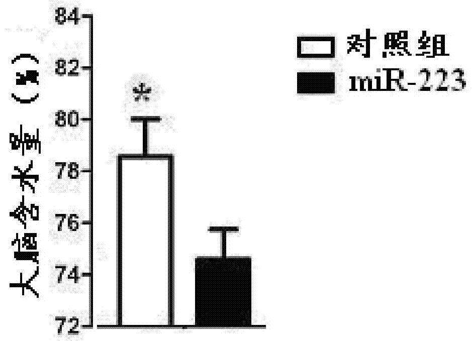 mir-223 complex targeting microglial cells and its preparation method and application