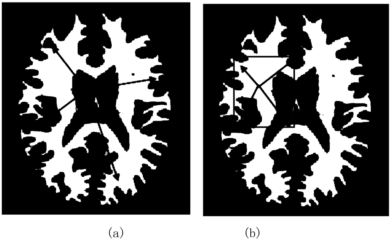A brain tissue segmentation method based on regularized graph segmentation