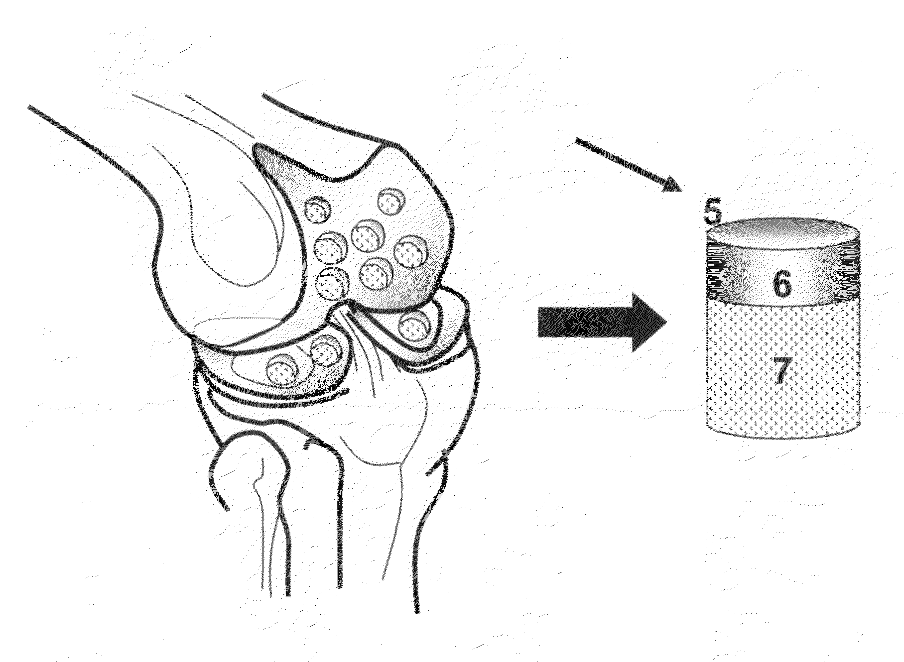 Crafting of cartilage