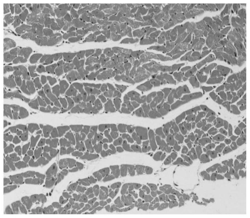 Preparation method of medicine containing betel nut and its anti-hypoxia application