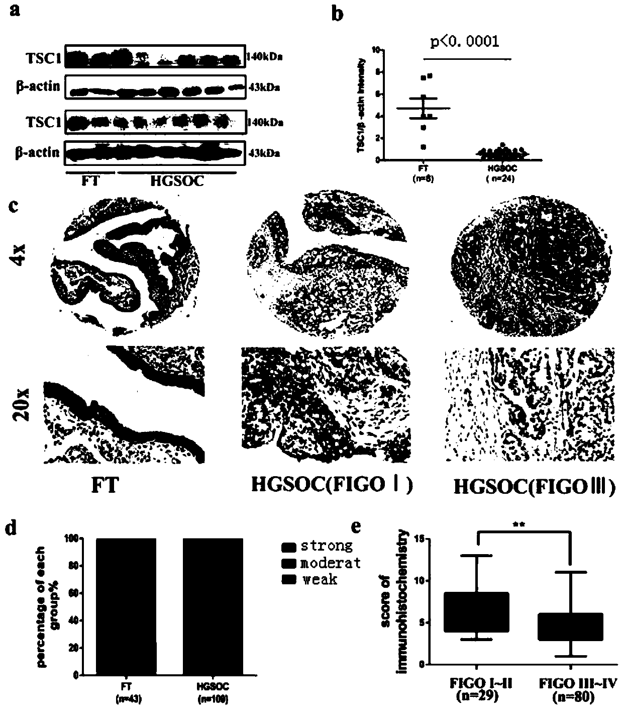 Application of mir-130a in the diagnosis, treatment and prognosis of ovarian cancer