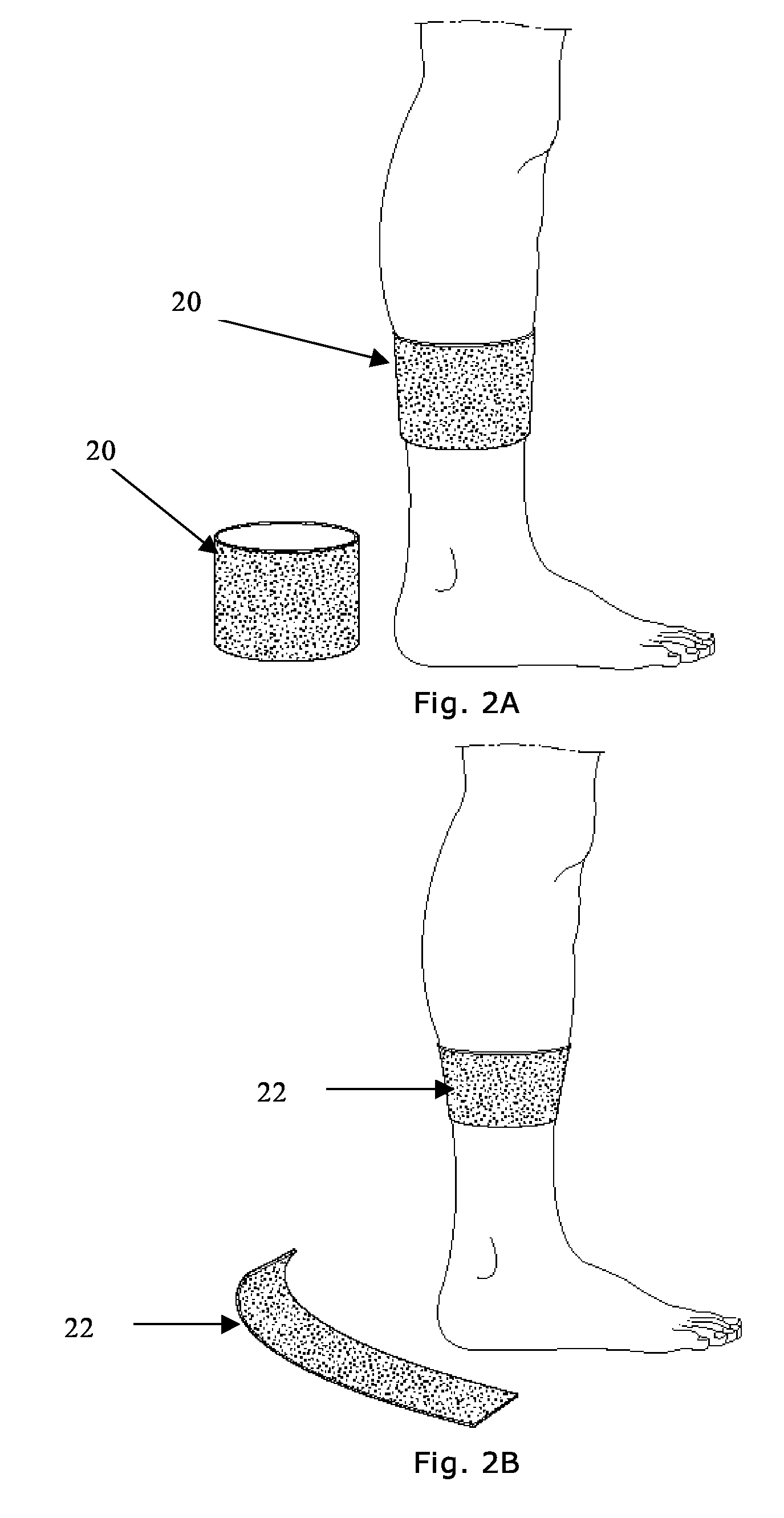 Cosmetic Treatment With Nitric Oxide, Device For Performing Said Treatment And Manufacturing Method Therefor