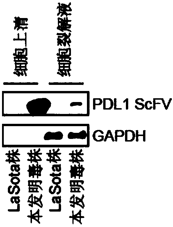 Preparation method and application of newcastle disease oncolytic virus expressing PD-L1 single chain antibody