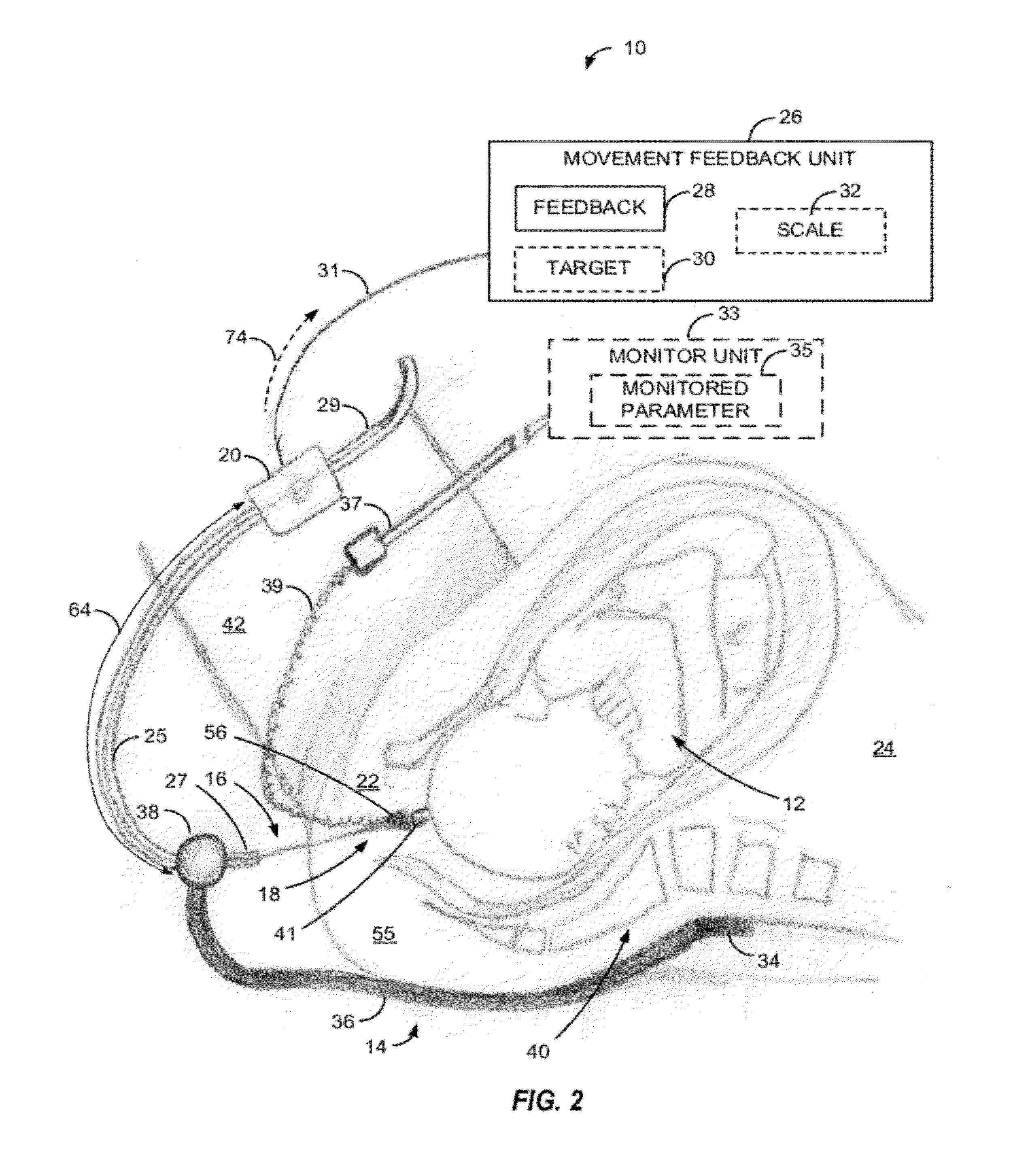 Apparatus and method of detecting movement of objects within the abdominal and/or pelvic region