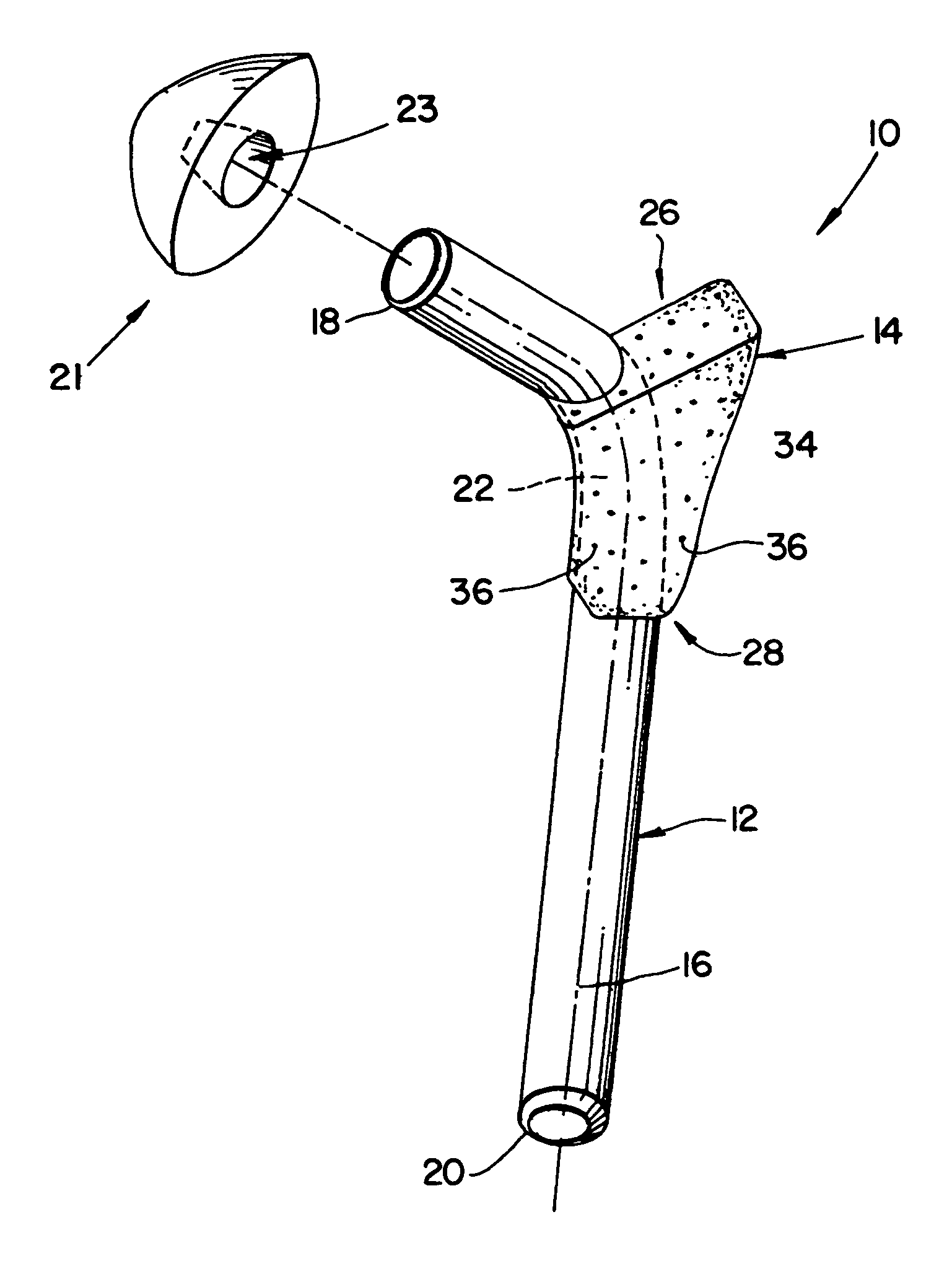 Implantable orthopedic prosthesis with textured polymeric surfaces