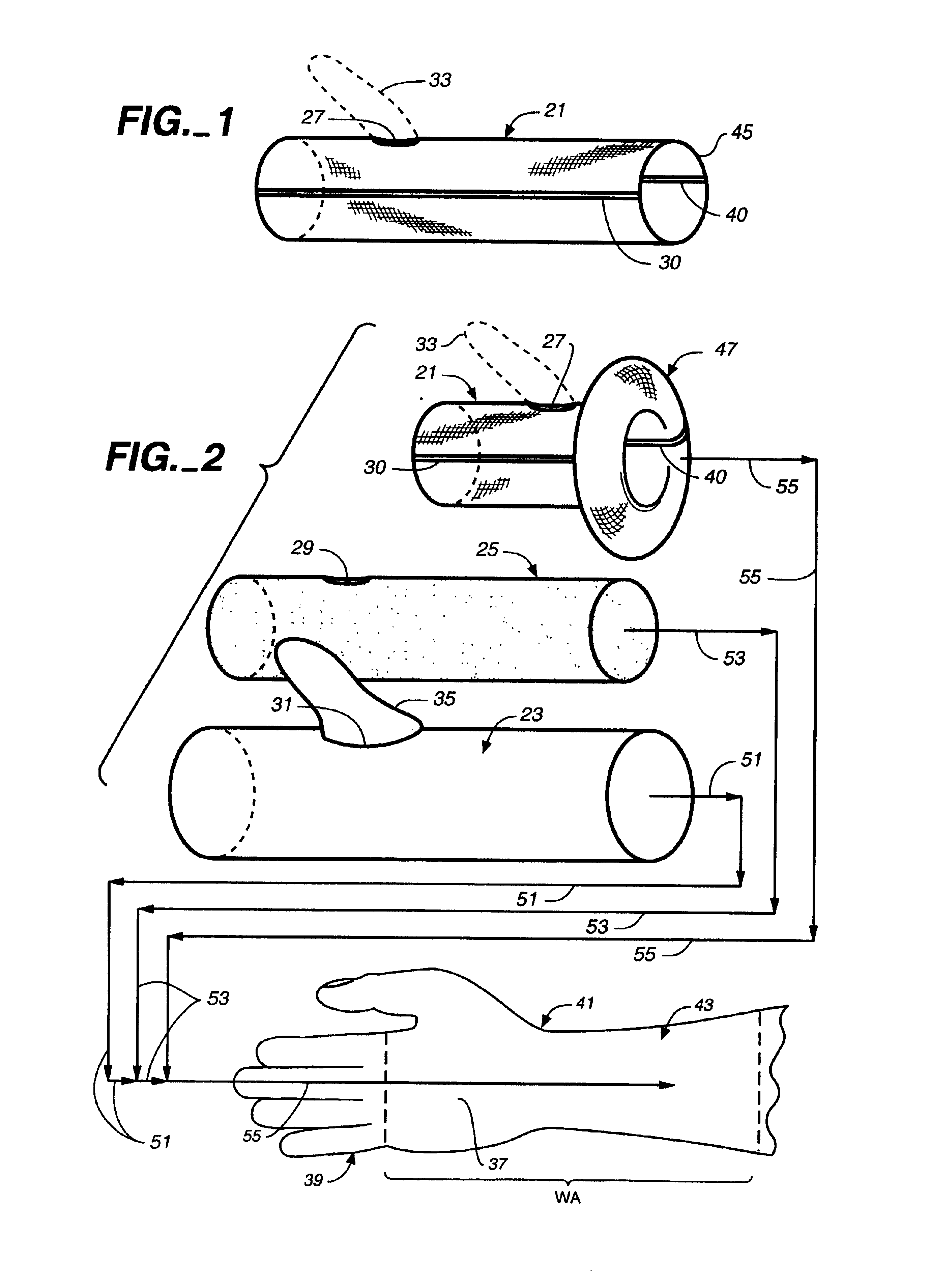 Custom molded wrist area impression kit and method