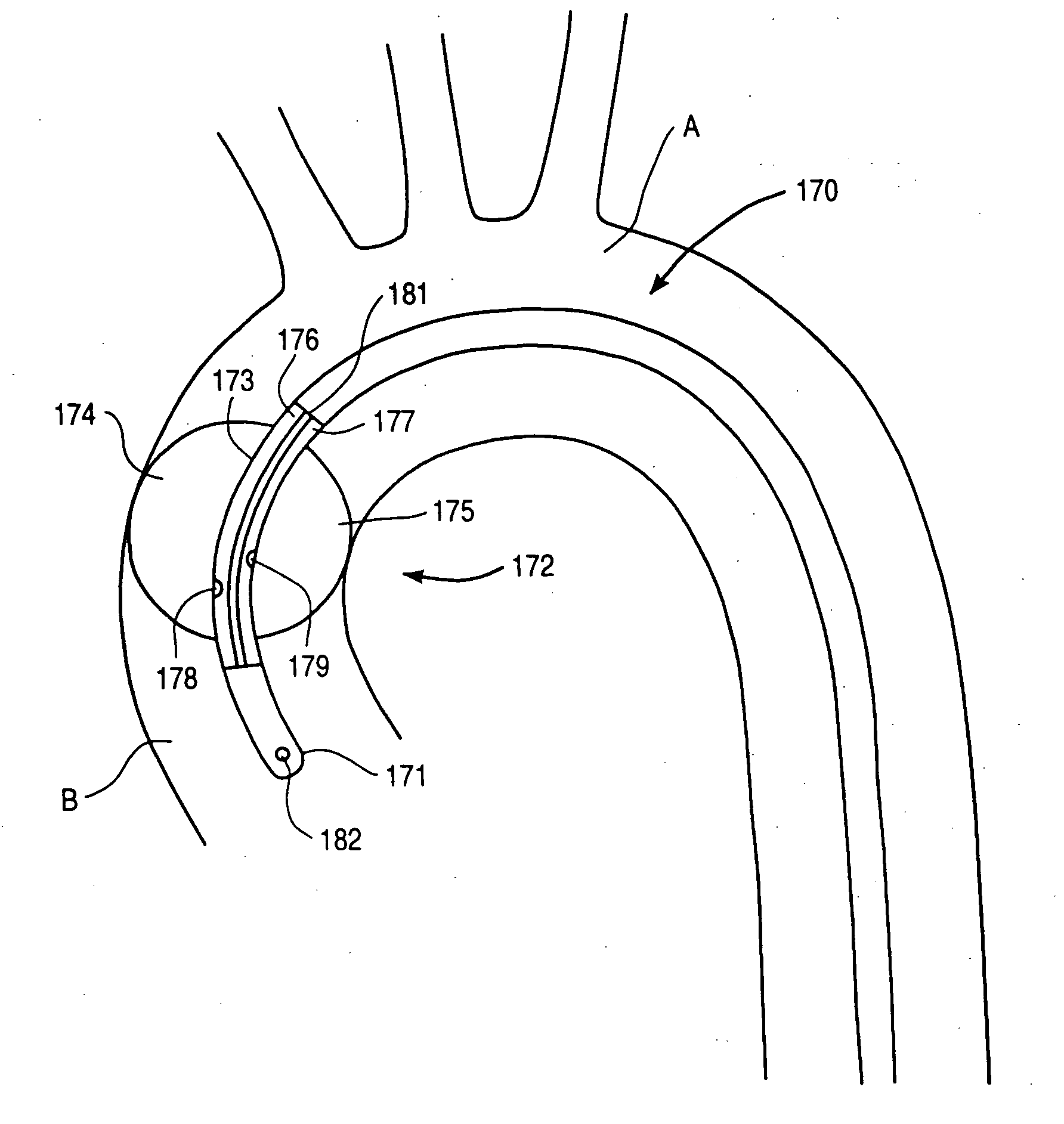 Methods and apparatus for anchoring an occluding member