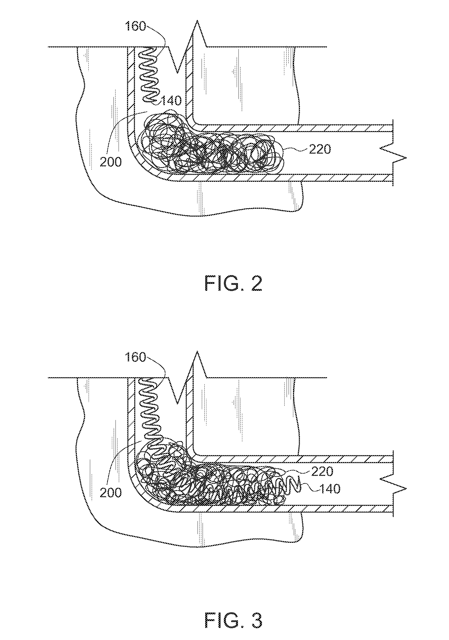 Apparatus to Capture and Extract Drain Clog Debris