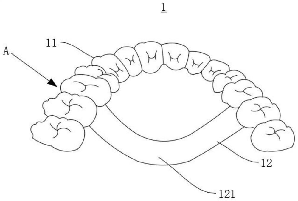 Design and manufacture of orthodontic appliances