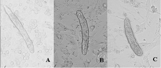 In-vitro schistosomulum co-culture method