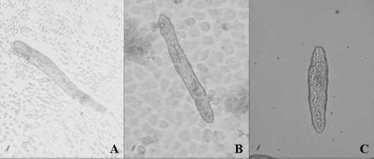 In-vitro schistosomulum co-culture method