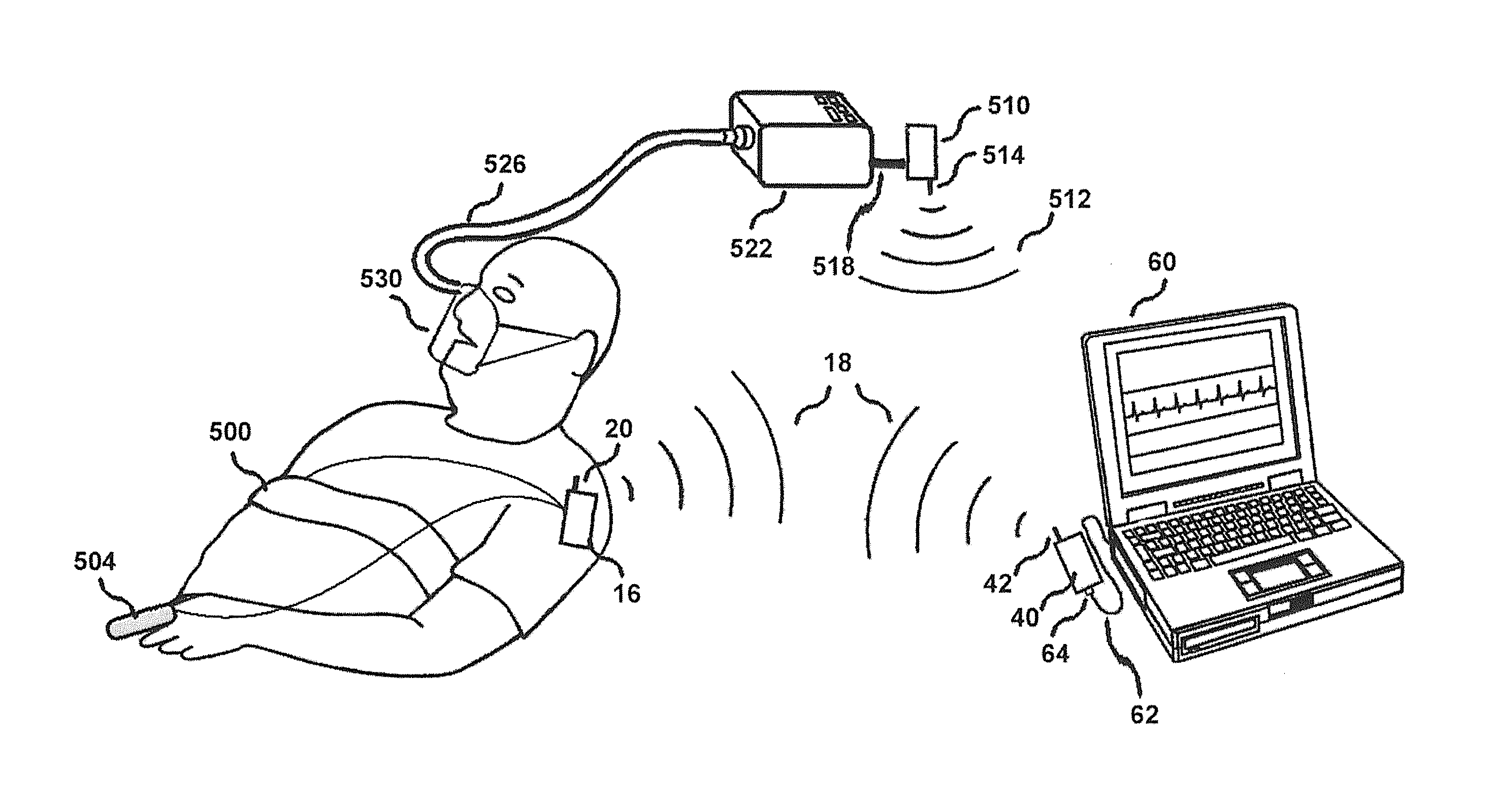 Integrated diagnostic and therapeutic system and method for improving treatment of subject with complex and central sleep apnea