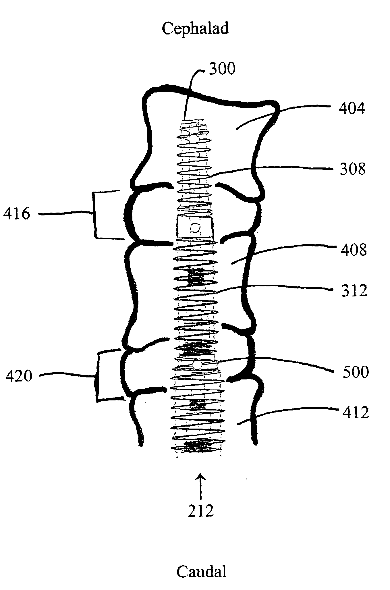 Methods and apparatus for provision of therapy to adjacent motion segments