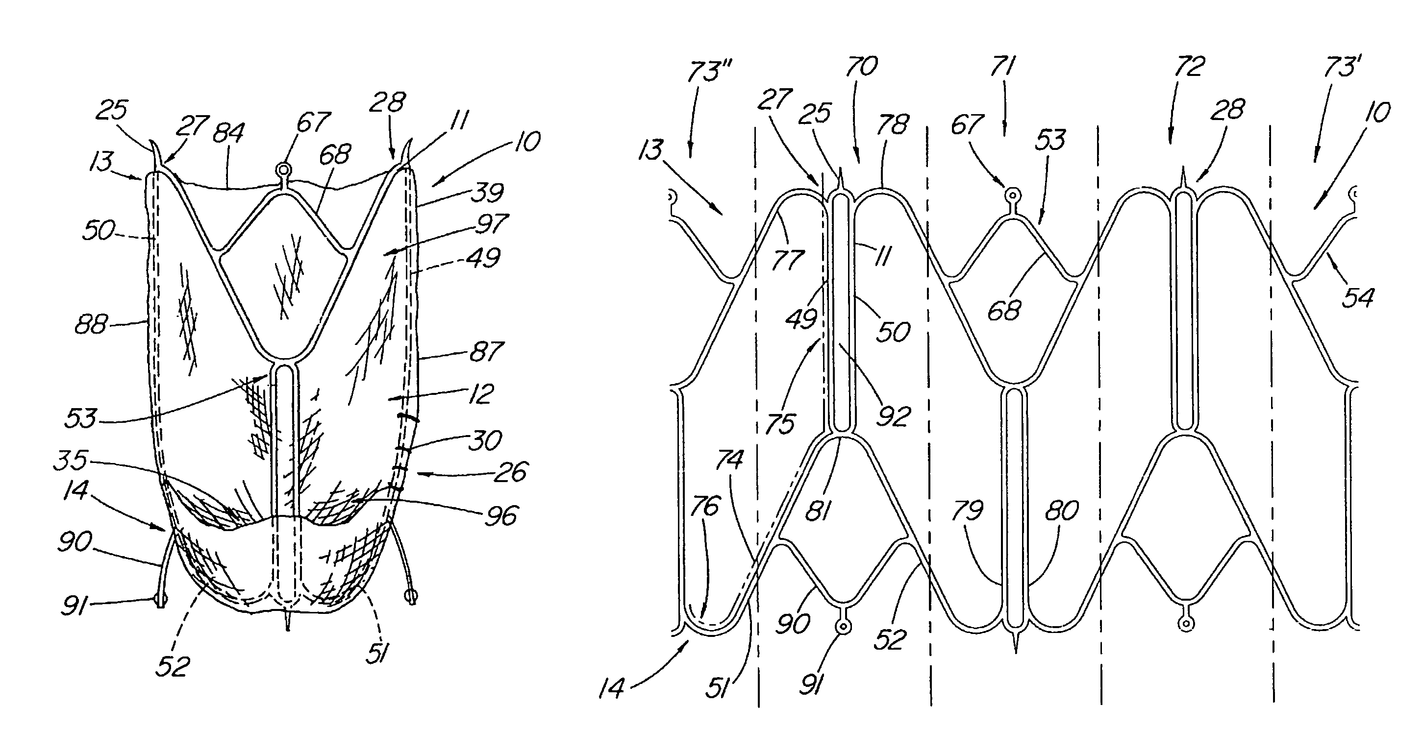 Artificial valve prosthesis with improved flow dynamics