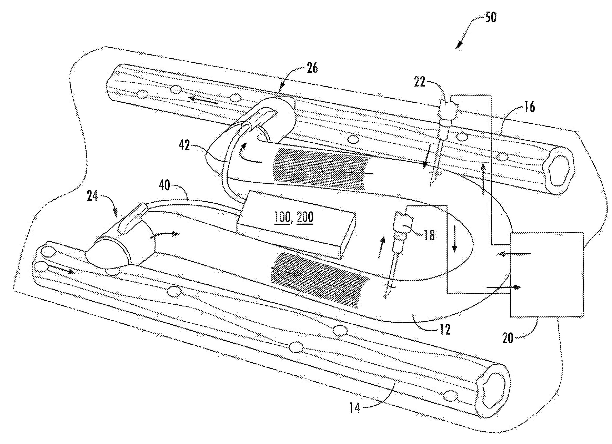 Magnetically activated arteriovenous access valve system and related methods