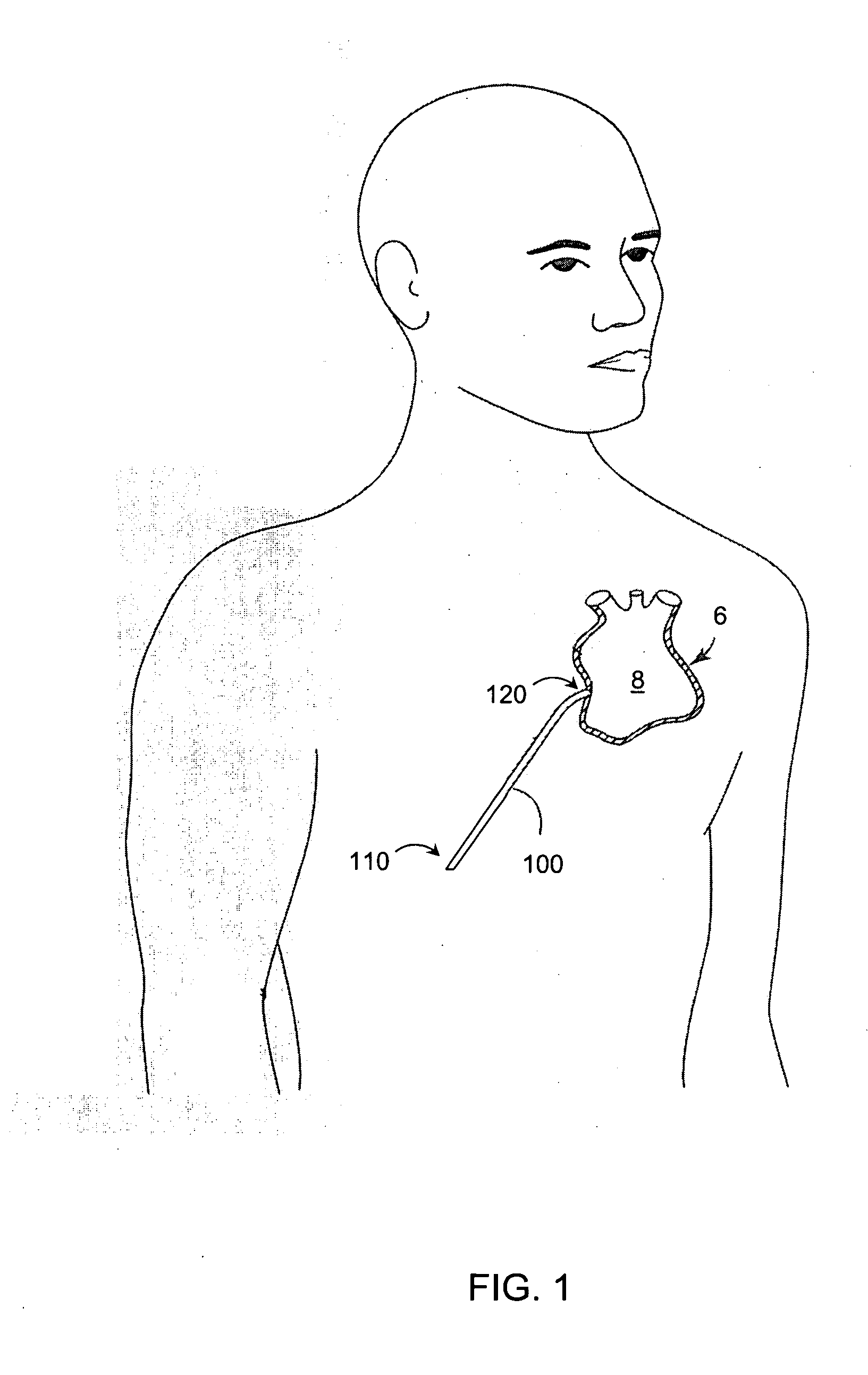 System and method for delivery of biologic agents