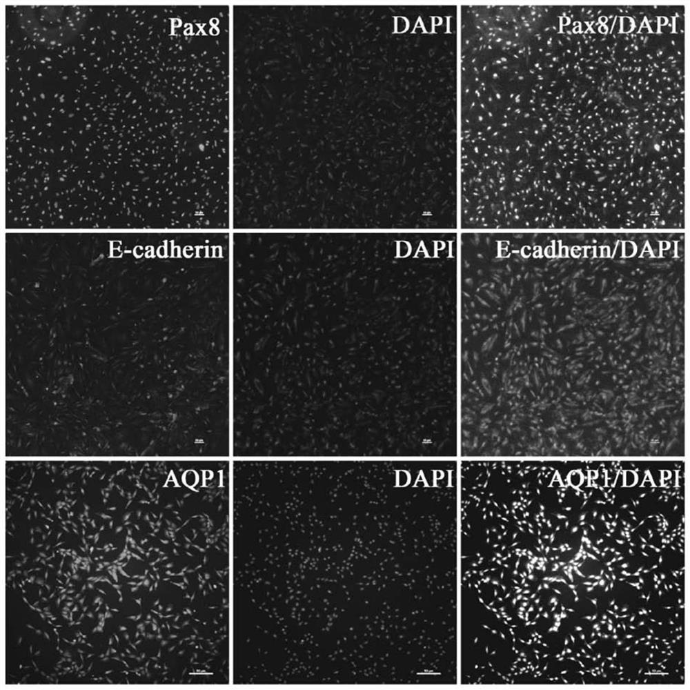 Establishment method of urine cell induced pluripotent stem cells of acute kidney injury patient