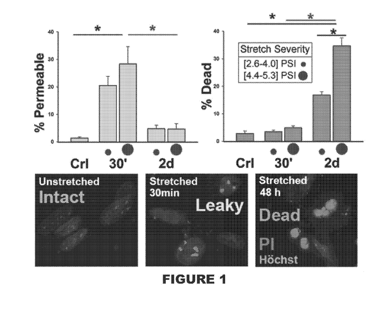 Astrocyte traumatome and neurotrauma biomarkers