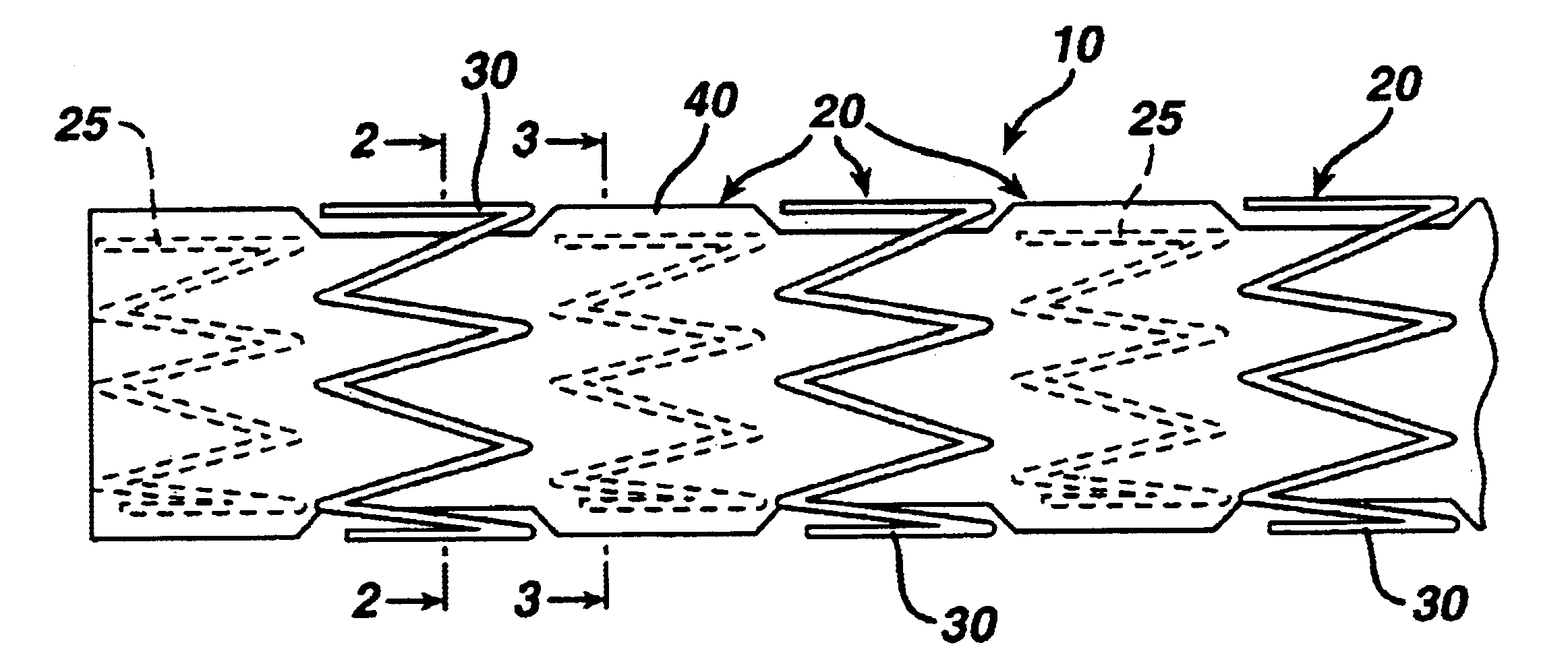 Covered segmented stent