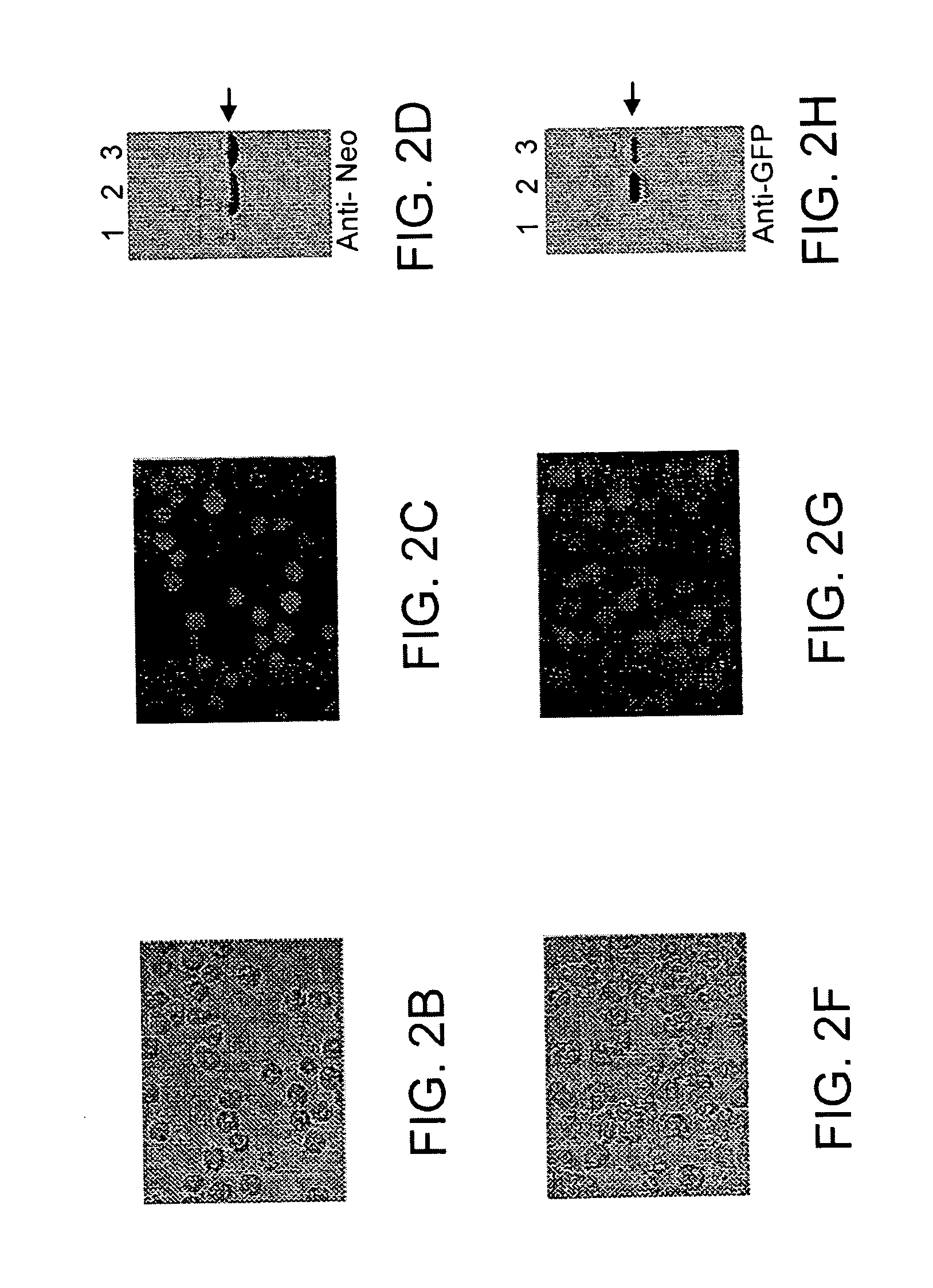 Stable Acanthamoeba protein expression systems