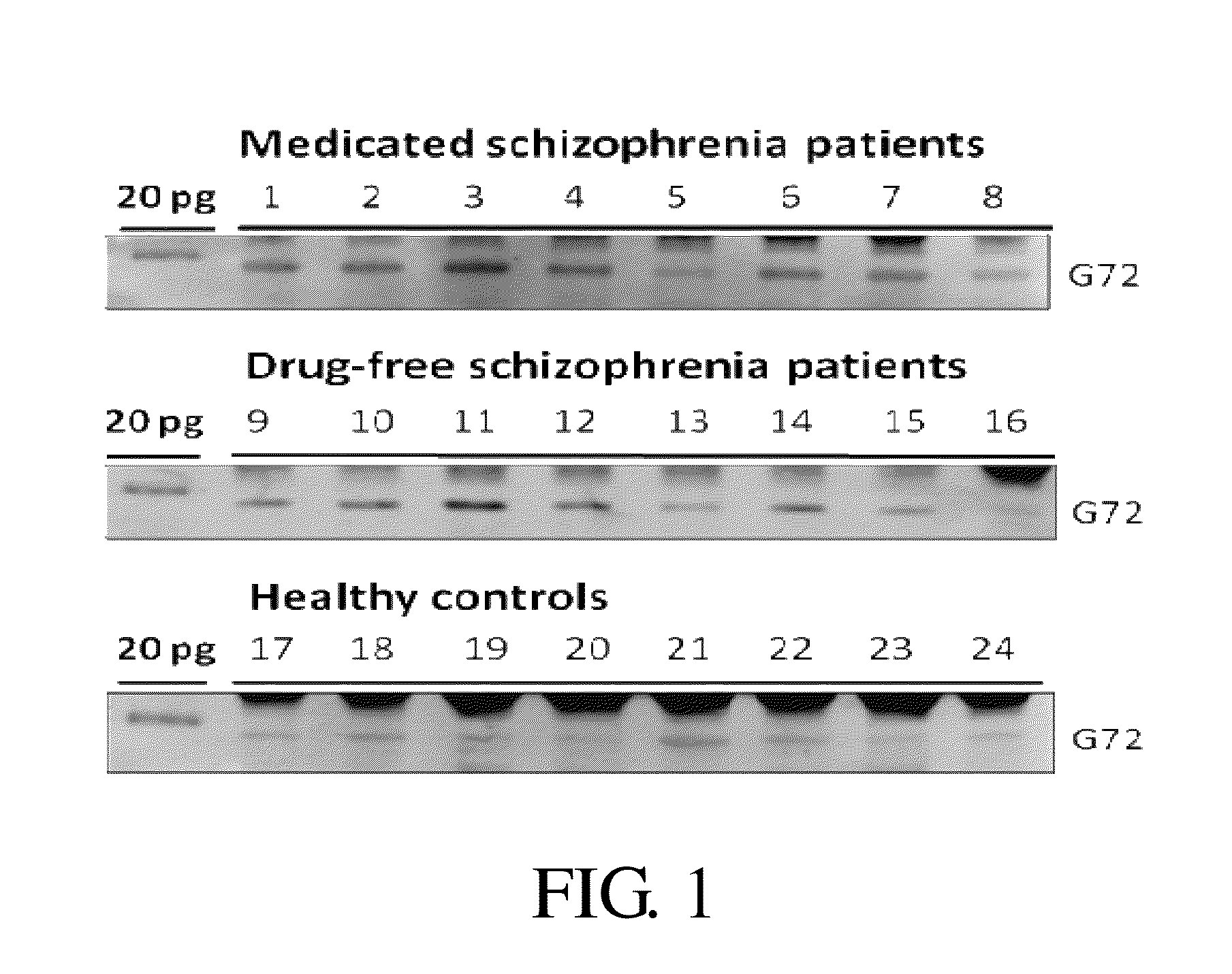 Compositions and methods for diagnosis of schizophrenia