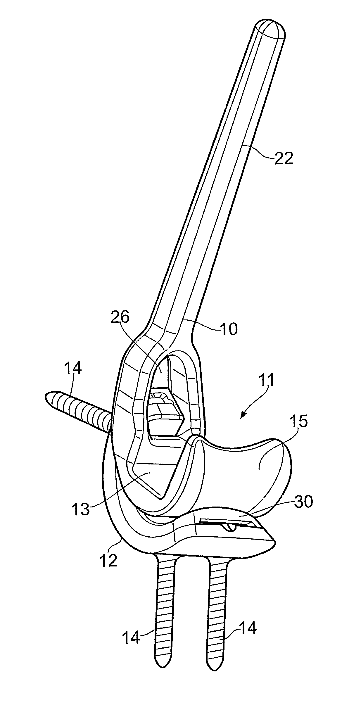 Canine prosthetic elbow joint