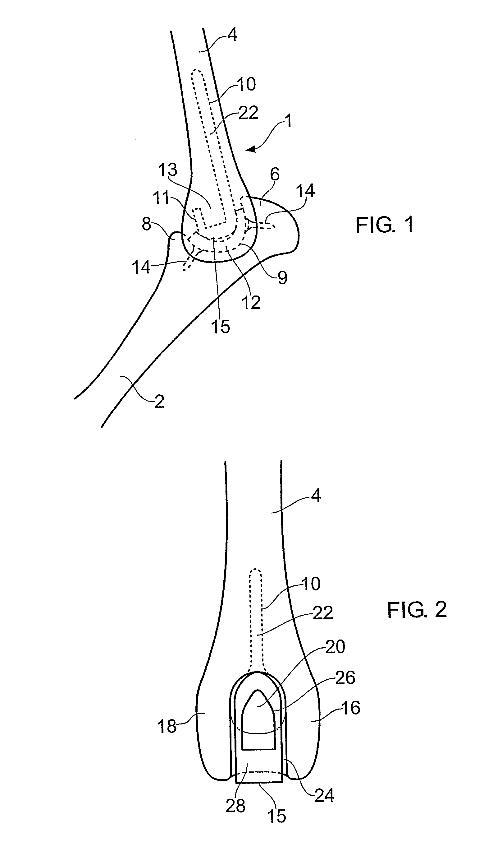 Canine prosthetic elbow joint