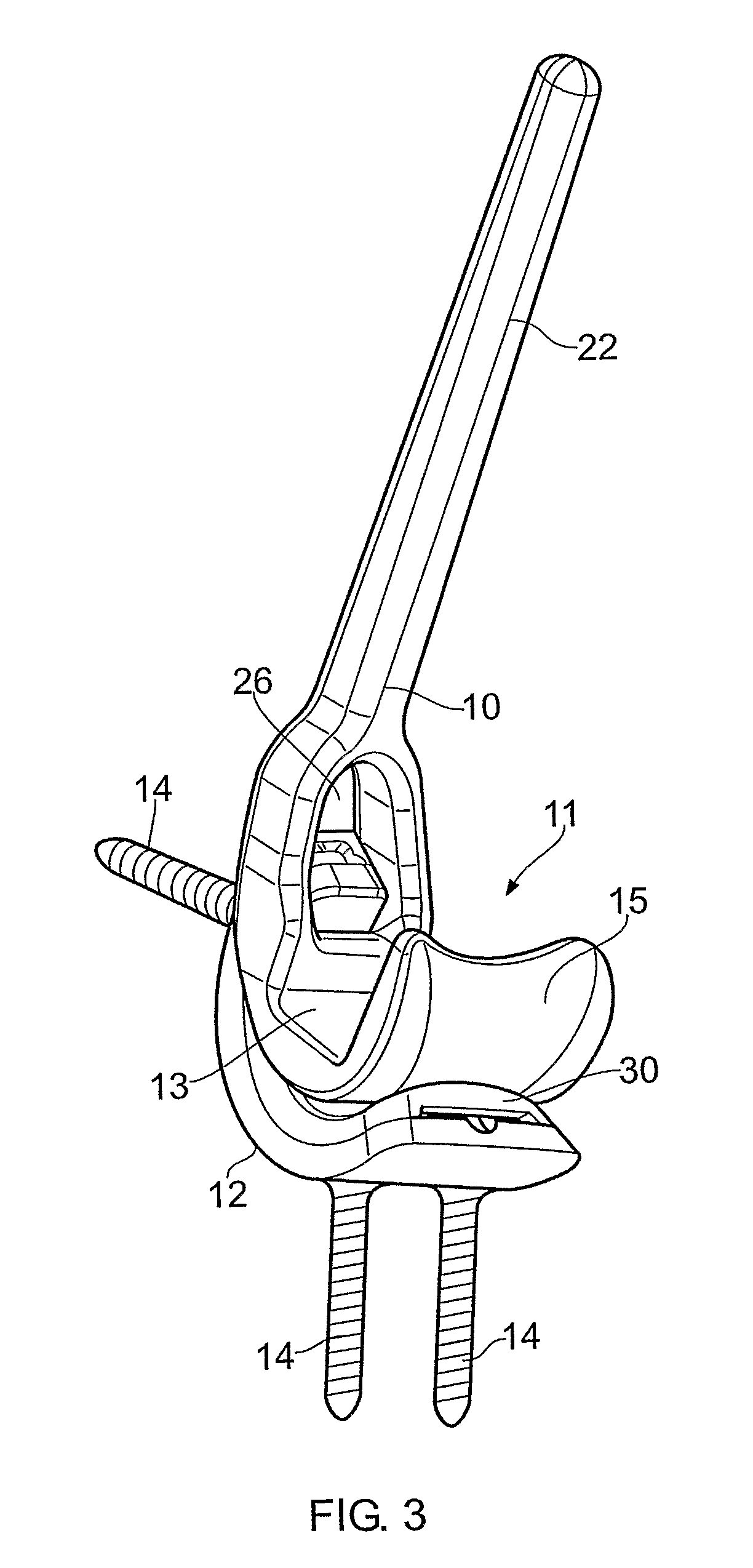 Canine prosthetic elbow joint