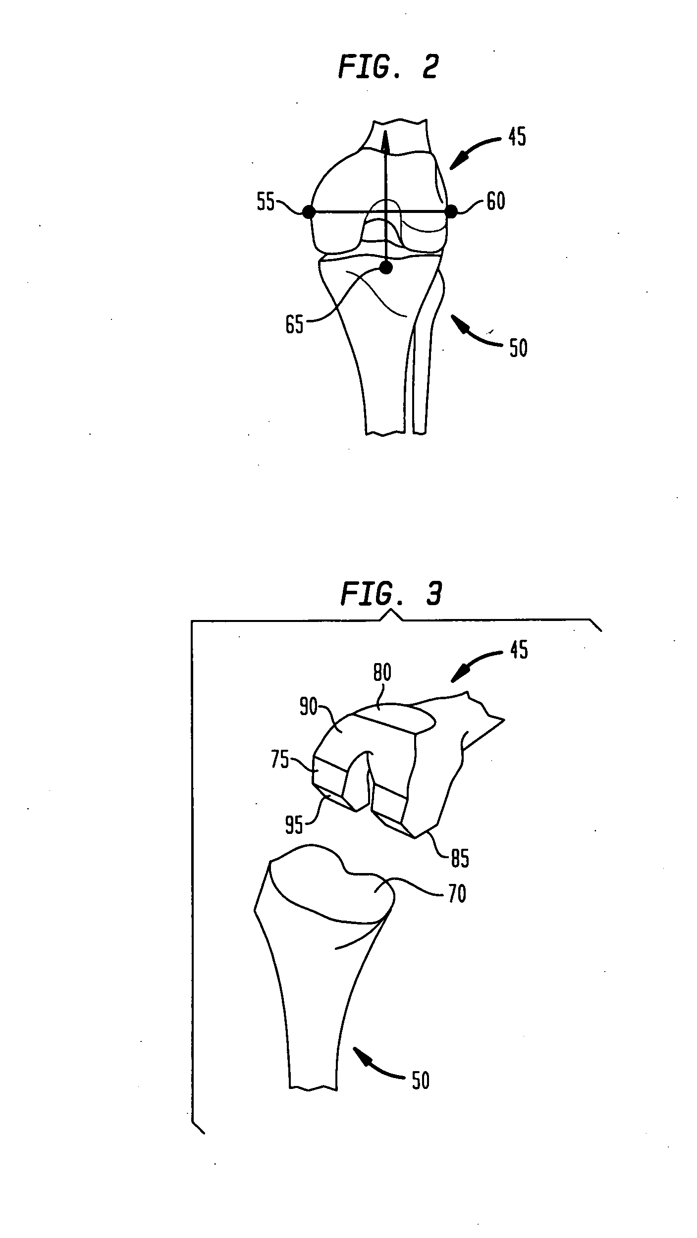 System and method for performing femoral sizing through navigation