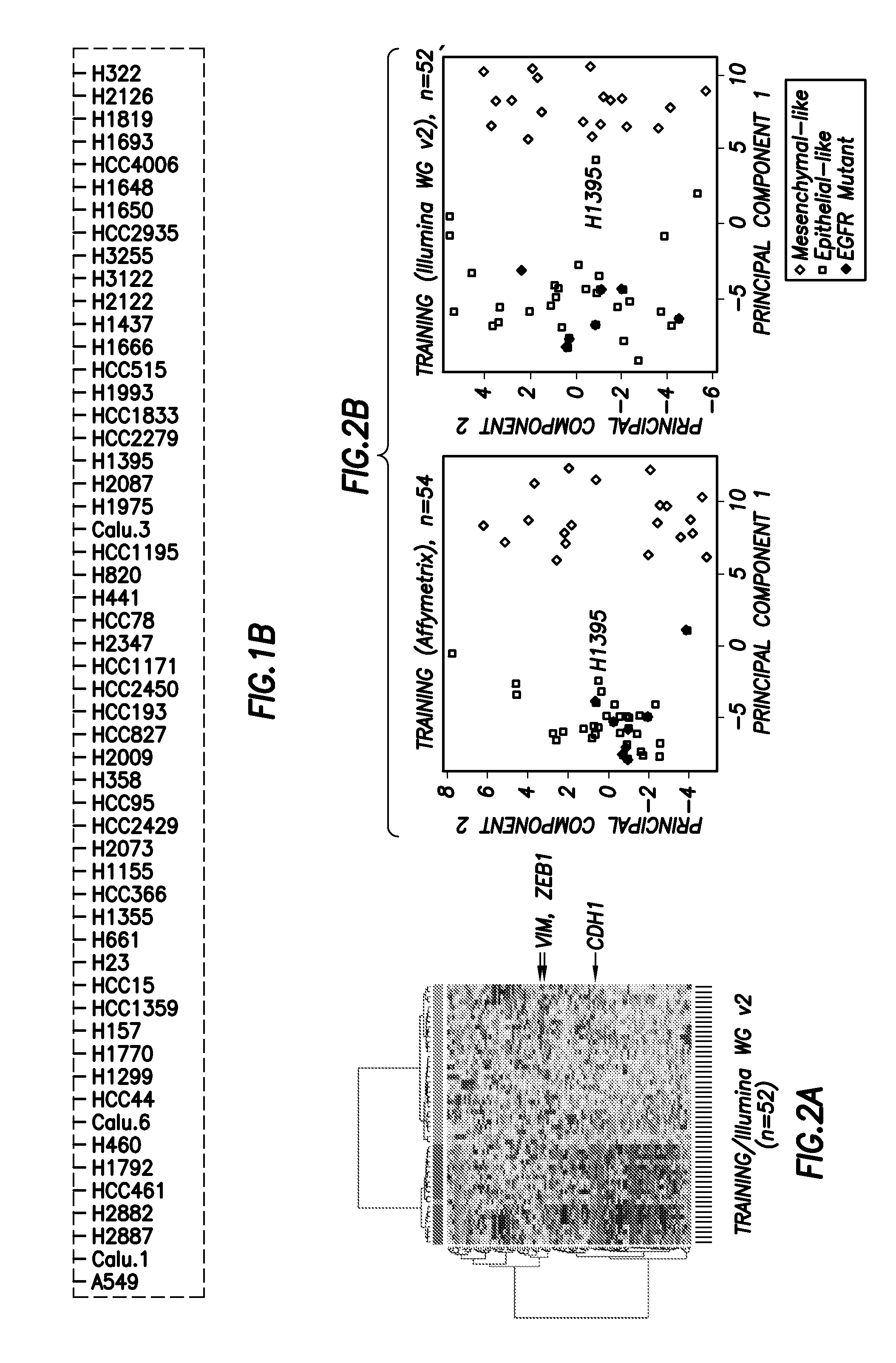 Emt signatures and predictive markers and method of using the same