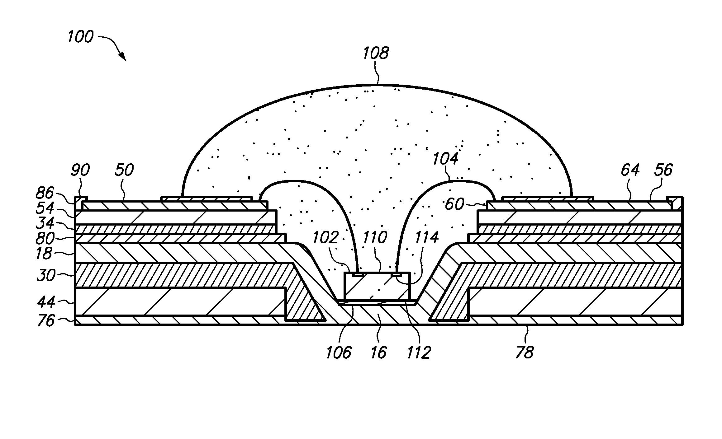 Method of making a semiconductor chip assembly with a bump/base/ledge heat spreader, dual adhesives and a cavity in the bump