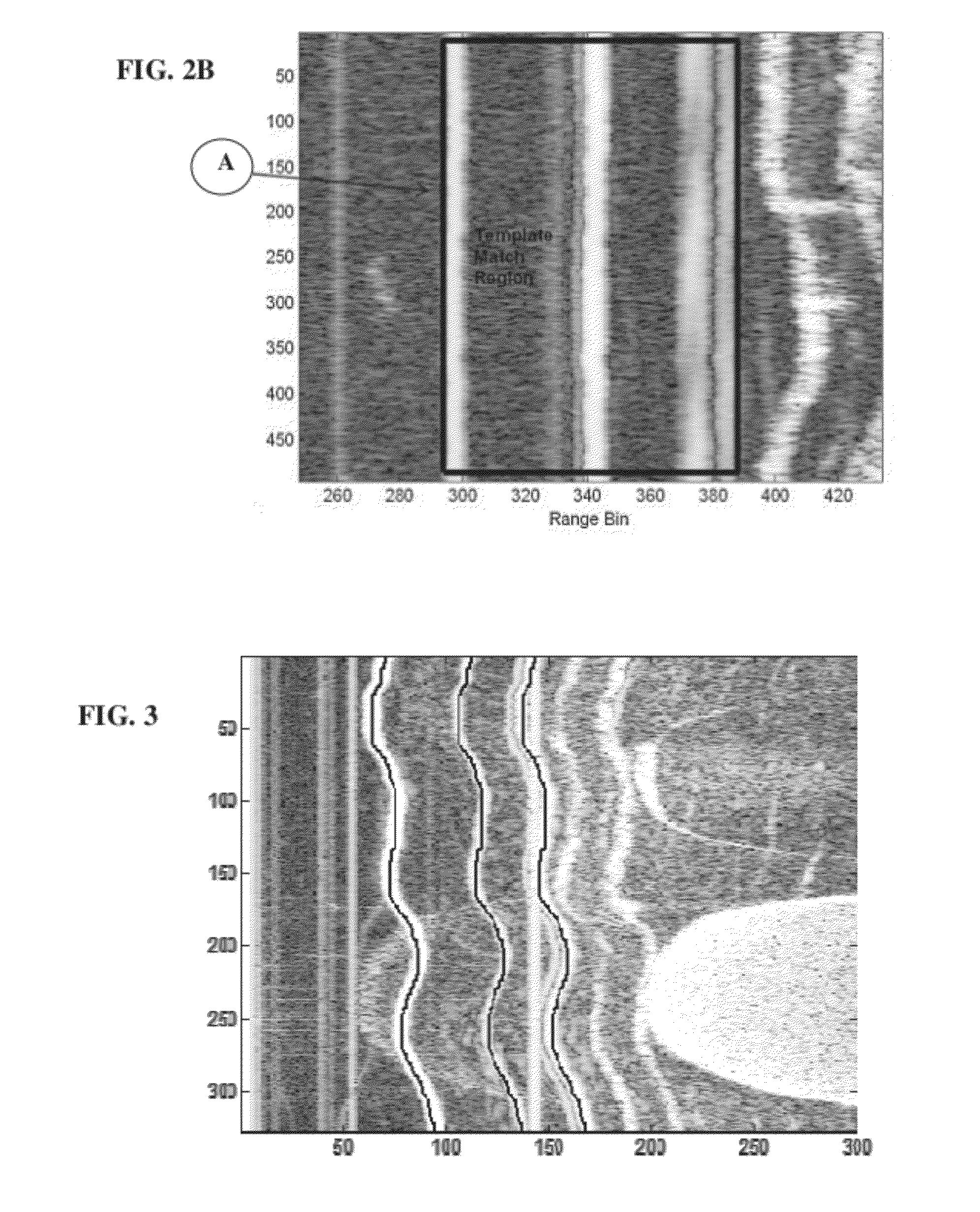 Automatic calibration systems and methods of use