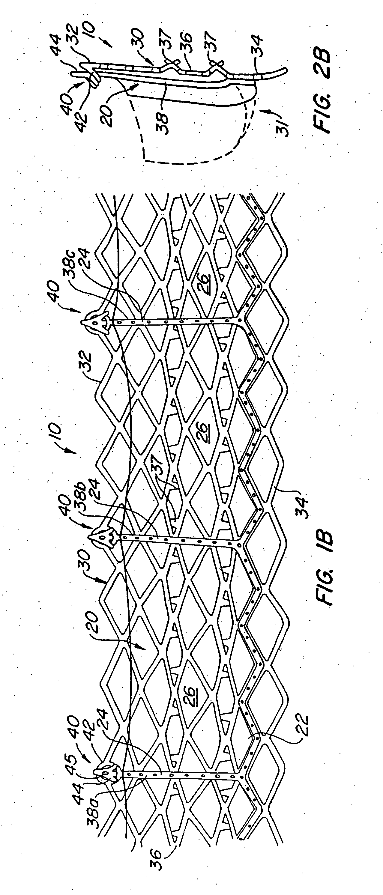 Externally expandable heart valve anchor and method