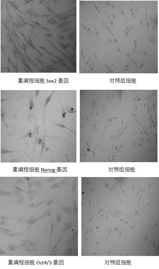 Preparation method and application of cell-stent composite material for cartilage injury repairing