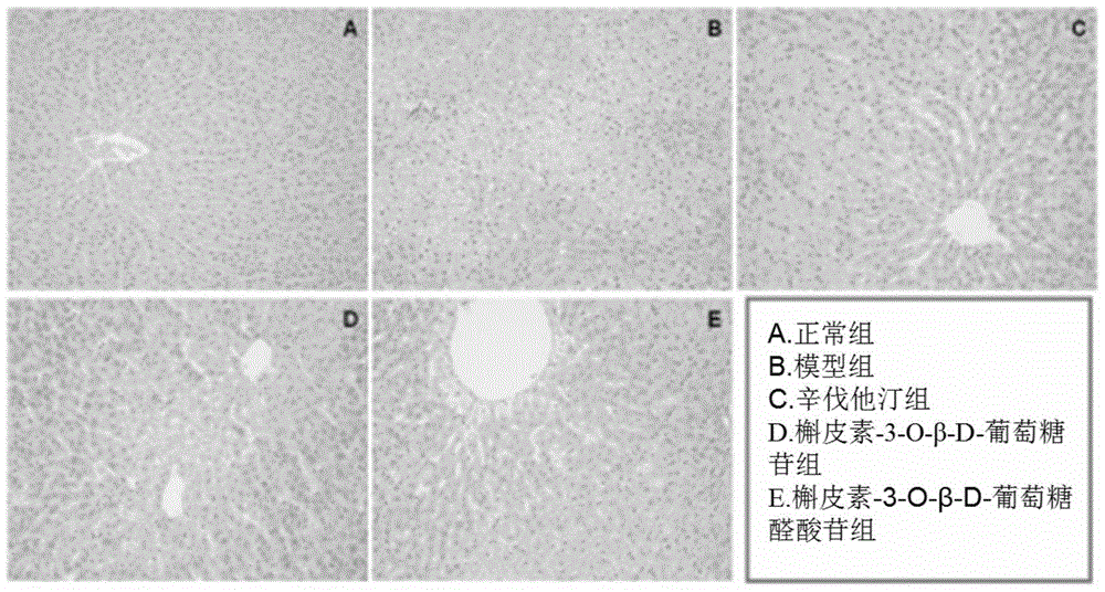 Application of quercetin-o-glycoside derivatives in the treatment of lipid metabolism disorders