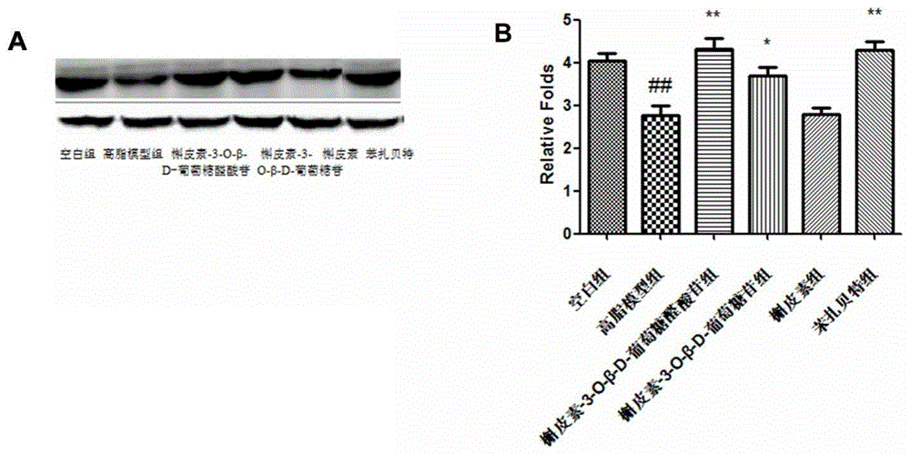 Application of quercetin-o-glycoside derivatives in the treatment of lipid metabolism disorders